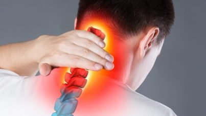 What is the Cervicalgia VA Rating