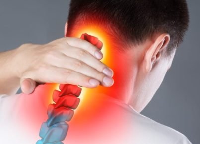 What is the Cervicalgia VA Rating